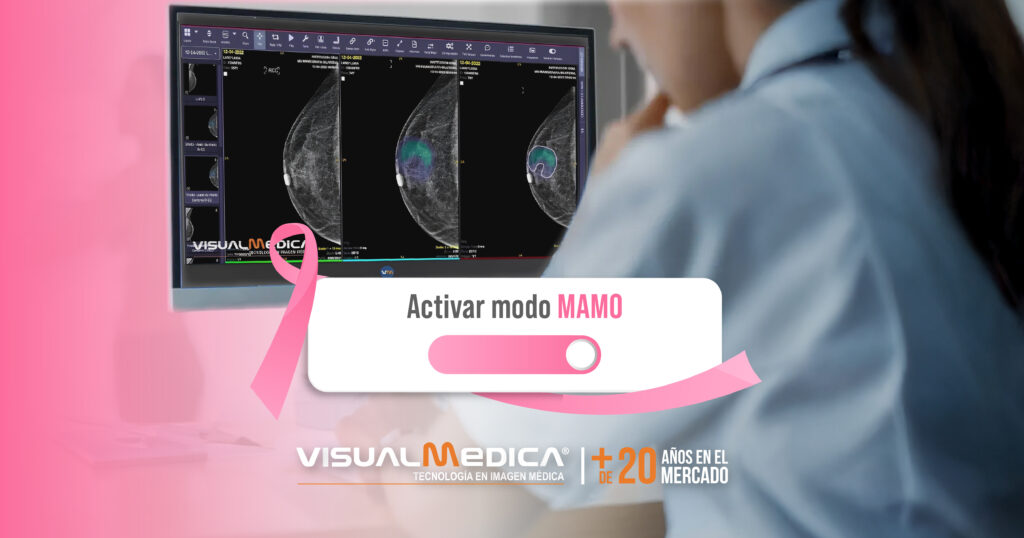 Octubre ROSA: Tecnología al servicio de la detección temprana del Cáncer de Mama.