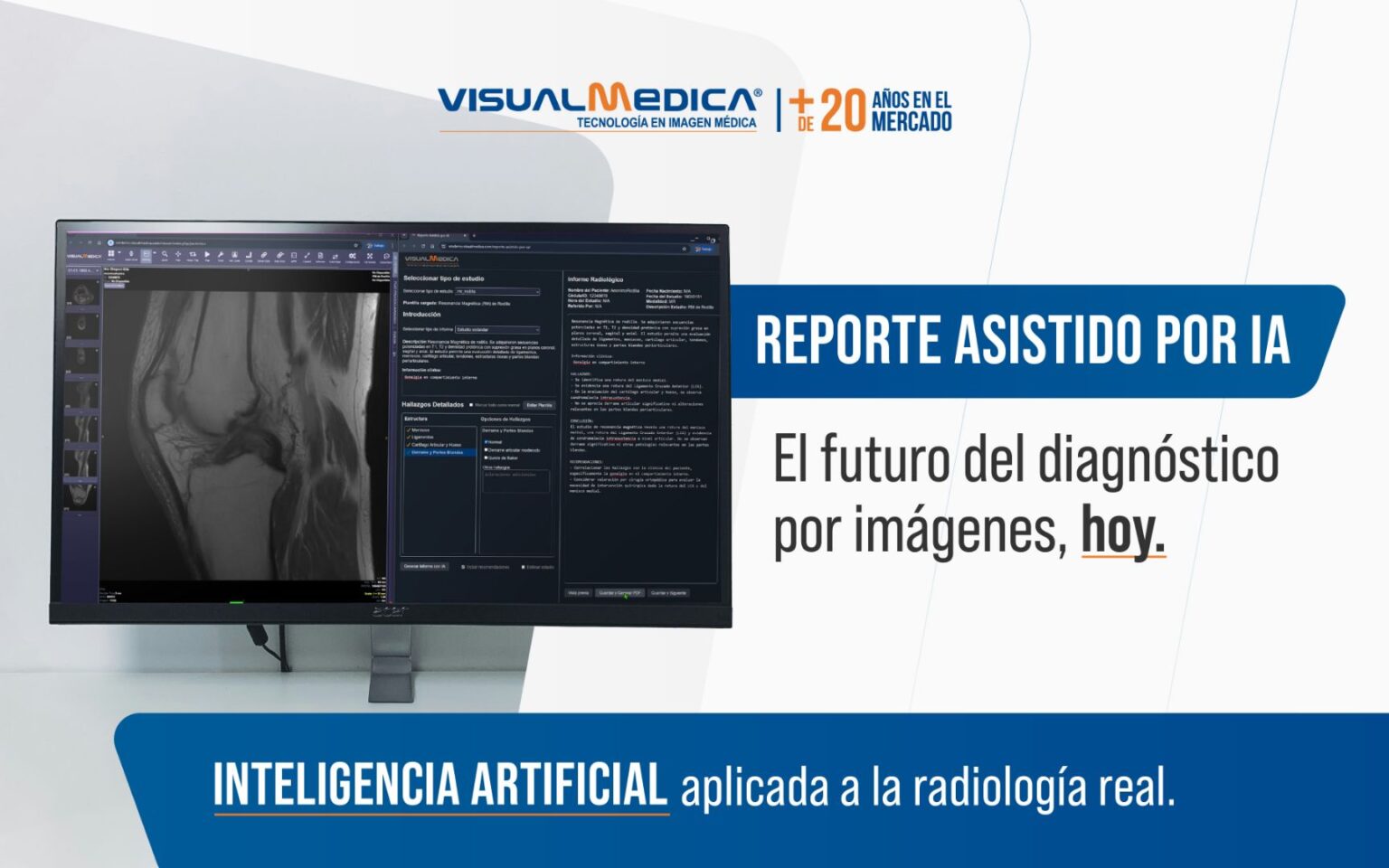 PACS RIS en la nube - Visualmedica